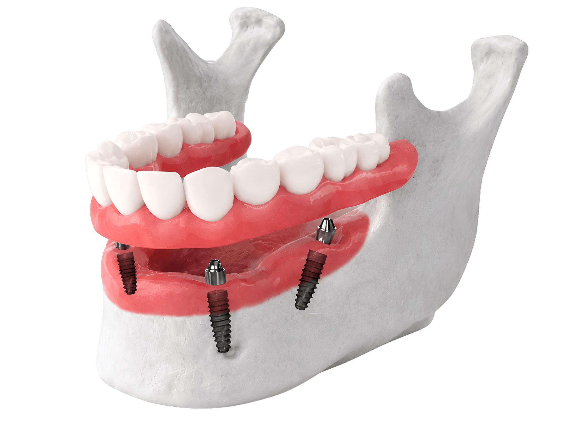 Програма для тотальної реабілітації TeethXpress